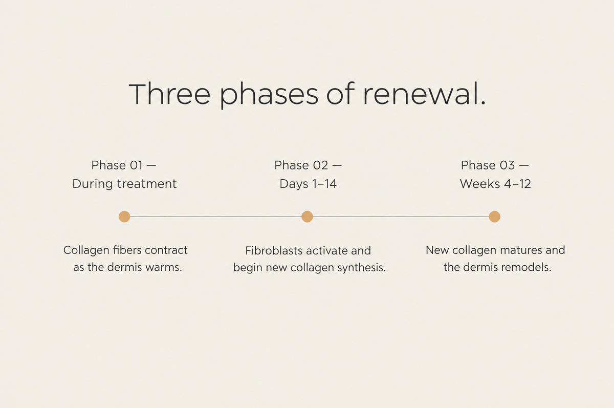 Three phases of skin renewal